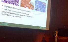 ofthalmiatros athina