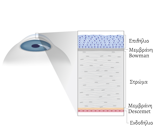 μεταμοσχευση κερατοειδους